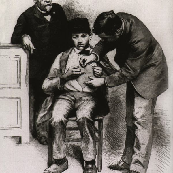 Rabies (hydrophobia) vaccination administered to teenage Jean-Baptiste Jupille at the Pasteur laboratory, in October 1885. This was the second successful test of the rabies vaccine, the first taking place in July 1882 on a 9 year old boy, Joseph Meister. Rabies and Hydrophobia